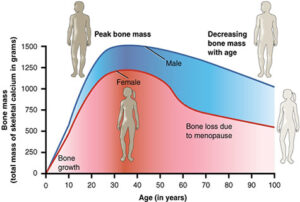 Age Increases Osteoporosis Risk